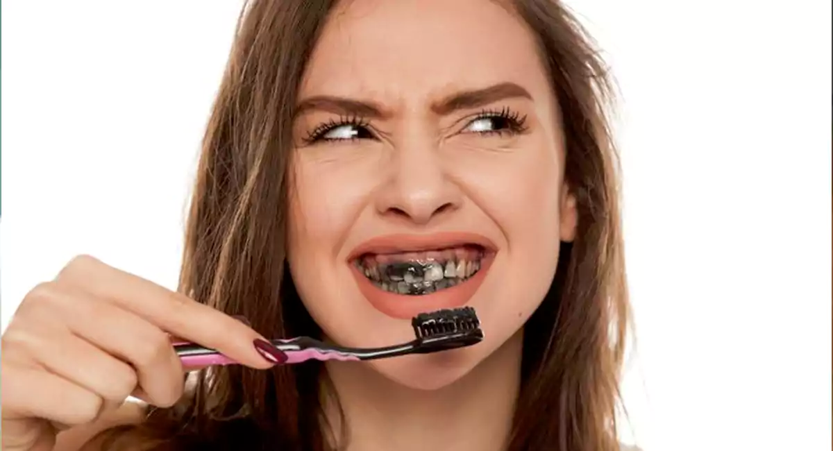 Effects of activated charcoal on teeth