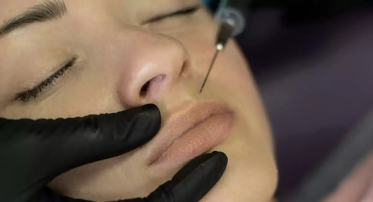 Frequently asked questions about lip injections